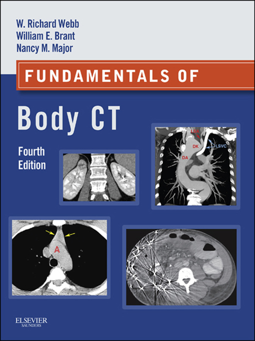 Title details for Fundamentals of Body CT E-Book by W. Richard Webb - Available